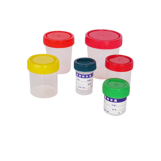 Vysoce kvalitn&iacute; OEM ODM Laboratorn&iacute; n&aacute;stroj Cena hematologie analyz&aacute;tor petri dish vzorek kontejneru vzorku